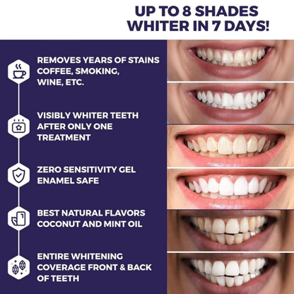 Teeth Whitening Strips: Get a Brighter, Whiter Smile in 14 Days